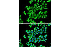 Immunofluorescence analysis of A549 cell using LCN2 antibody. (Lipocalin 2 Antikörper)