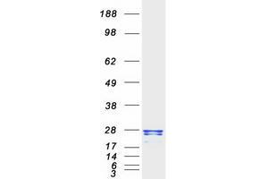 Western Blotting (WB) image for Regulator of G-Protein Signaling 2 (RGS2) protein (Myc-DYKDDDDK Tag) (ABIN2730827)
