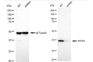 Western blotting analysis using NSDHL antibody (ABIN7799539).