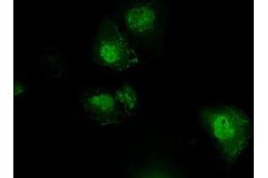 Anti-PLEK mouse monoclonal antibody (ABIN2453486) immunofluorescent staining of COS7 cells transiently transfected by pCMV6-ENTRY PLEK (RC203780). (Pleckstrin Antikörper)