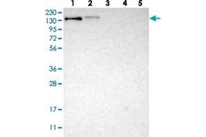 Western blot analysis of Lane 1: RT-4, Lane 2: U-251 MG, Lane 3: Human Plasma, Lane 4: Liver, Lane 5: Tonsil with LRIG2 polyclonal antibody . (LRIG2 Antikörper)