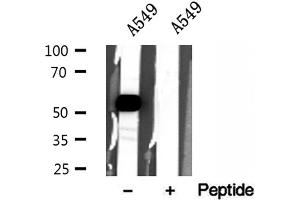 Western blot analysis of extracts of A549 cells, using ZnT7 antibody. (SLC30A7 Antikörper  (N-Term))