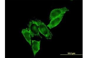 Immunofluorescence of monoclonal antibody to MMP9 on HeLa cell. (MMP 9 Antikörper  (AA 1-707))
