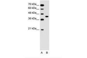 Image no. 1 for anti-Solute Carrier Family 35, Member B1 (SLC35B1) (AA 288-337) antibody (ABIN205013) (SLC35B1 Antikörper  (AA 288-337))