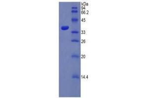 SDS-PAGE analysis of Rat PST Protein.