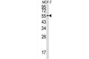 Western Blotting (WB) image for anti-Eukaryotic Translation Elongation Factor 1 alpha 1 (EEF1A1) antibody (ABIN3002705) (eEF1A1 Antikörper)