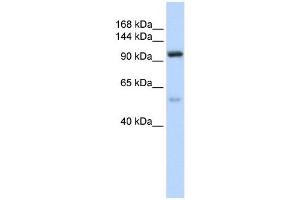 NOL6 antibody used at 1 ug/ml to detect target protein. (Nucleolar Protein 6 Antikörper)