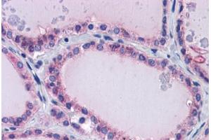 Human Thyroid: Formalin-Fixed, Paraffin-Embedded (FFPE) (PAX8 Antikörper  (AA 215-264))