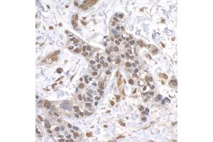 anti-Ubiquitin Specific Peptidase 1 (USP1) (AA 450-500) antibody