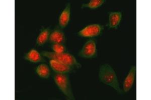 IF analysis of ATF6 using anti-ATF6 antibody (ABIN7602466) and anti-Beta Tubulin antibody (ABIN7602743). (ATF6 Antikörper  (AA 79-670))