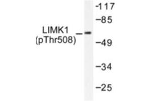 Image no. 1 for anti-LIM Domain Kinase 1 (LIMK1) (pThr508) antibody (ABIN318062) (LIM Domain Kinase 1 Antikörper  (pThr508))