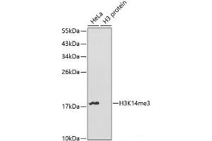 Western blot analysis of extracts of various cell lines using TriMethyl-Histone H3-K14 Polyclonal Antibody. (Histone 3 Antikörper  (3meLys14))