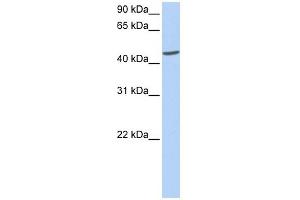 ICA1 antibody used at 1 ug/ml to detect target protein.