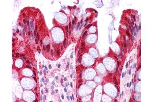 Immunohistochemistry (IHC) image for anti-Fatty Acid Binding Protein 1, Liver (FABP1) (N-Term) antibody (ABIN502840) (FABP1 Antikörper  (N-Term))