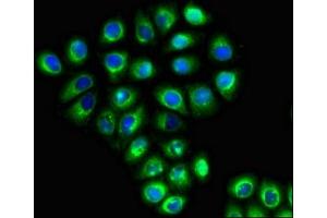 Immunofluorescent analysis of A549 cells using ABIN7169952 at dilution of 1:100 and Alexa Fluor 488-congugated AffiniPure Goat Anti-Rabbit IgG(H+L) (SLC6A13 Antikörper  (AA 1-40))