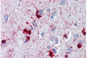Brain, cortex, Human: Formalin-Fixed, Paraffin-Embedded (FFPE) (CRYAB Antikörper)