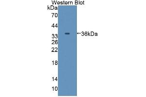 Detection of Recombinant C8a, Mouse using Polyclonal Antibody to Complement Component 8a (C8a) (C8A Antikörper  (AA 21-300))