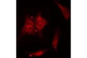 ABIN6277520 staining  NIH-3T3 cells by IF/ICC. (PTGES3 Antikörper  (C-Term))