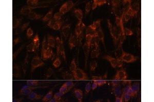 Immunofluorescence analysis of C6 cells using TLR3 Polyclonal Antibody at dilution of 1:100. (TLR3 Antikörper)