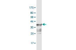 Western Blot detection against Immunogen (37. (SLC44A2 Antikörper  (AA 123-230))