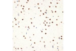 Immunohistochemistry of paraffin-embedded rat brain using N Rabbit mAb (ABIN7268774) at dilution of 1:100 (40x lens).