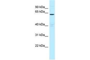 Image no. 1 for anti-Myotubularin Related Protein 6 (MTMR6) (AA 531-580) antibody (ABIN6747841)