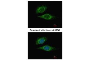 ICC/IF Image Immunofluorescence analysis of methanol-fixed HeLa, using ESE1, antibody at 1:500 dilution. (ELF3 Antikörper  (C-Term))