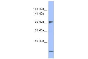 WB Suggested Anti-PSMD1 Antibody Titration: 0. (PSMD1 Antikörper  (N-Term))