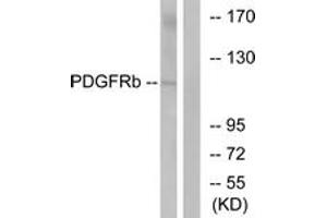 Western Blotting (WB) image for anti-Platelet Derived Growth Factor Receptor beta (PDGFRB) (AA 718-767) antibody (ABIN2889053) (PDGFRB Antikörper  (AA 718-767))