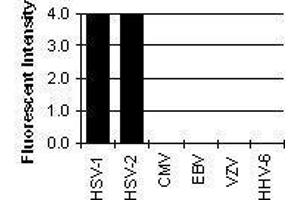 Cross Reactivity Results determined by IFA (HSV gB Antikörper)