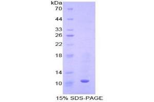 SDS-PAGE analysis of Mouse Metallothionein 3 Protein.