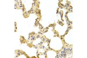 Immunohistochemistry of paraffin-embedded rat lung using TRAF2 antibody at dilution of 1:100 (x400 lens). (TRAF2 Antikörper)