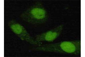 Immunofluorescence staining of HeLa cells using JARID1C monoclonal antibody  at 1:200 dilution. (KDM5C Antikörper  (C-Term))