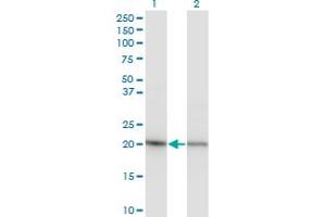 Western Blotting (WB) image for anti-Ribosomal Protein S5 (RPS5) (AA 106-204) antibody (ABIN519885)