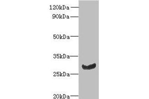 Western blot All lanes: C11orf68 antibody at 3 μg/mL + Mouse liver tissue Secondary Goat polyclonal to rabbit IgG at 1/10000 dilution Predicted band size: 28, 32 kDa Observed band size: 28 kDa (C11orf68 Antikörper  (AA 1-251))