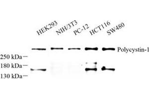 Western blot analysis of Polycystin-1 (ABIN7075124) at dilution of 1: 500