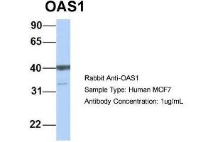 Host: Rabbit  Target Name: OAS1  Sample Tissue: Human MCF7  Antibody Dilution: 1. (OAS1 Antikörper  (C-Term))