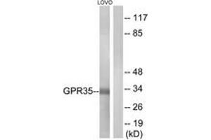 Western blot analysis of extracts from LOVO cells, using GPR35 Antibody. (GPR35 Antikörper  (AA 51-100))