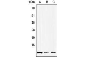 Western blot analysis of HMGN1 expression in Hela (A), NIH3T3 (B), H9C2 (C) whole cell lysates. (HMGN1 Antikörper  (Center))