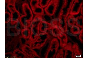 Formalin-fixed and paraffin embedded rat kidney labeled with Anti-Integrin Î±E2 Polyclonal Antibody, Unconjugated (ABIN678758) at 1:200 followed by conjugation to the secondary antibody Goat Anti-Rabbit IgG, PE conjugated used at 1:200 dilution for 40 minutes at 37 °C. (Integrin, alpha E2 (AA 1101-1179) Antikörper)