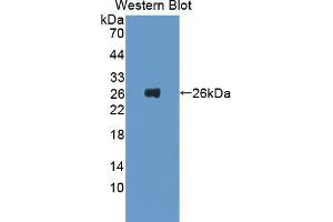 Western blot analysis of the recombinant protein. (FTL Antikörper  (AA 5-183))