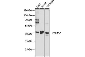 Western blot analysis of extracts of various cell lines, using PNM antibody (ABIN6128525, ABIN6145844, ABIN6145845 and ABIN6220635) at 1:3000 dilution. (PNMA2 Antikörper  (AA 1-140))