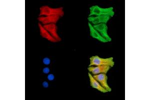 ABIN7095321 and ABIN7099378 staining Hela cells by IF/ICC.