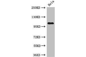 Western Blot Positive WB detected in: Hela whole cell lysate All lanes: USP33 antibody at 3 μg/mL Secondary Goat polyclonal to rabbit IgG at 1/50000 dilution Predicted band size: 107, 104, 94 kDa Observed band size: 107 kDa (USP33 Antikörper  (C-Term))