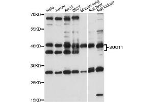Western blot analysis of extracts of various cell lines, using SUGT1 antibody (ABIN6293563) at 1:1000 dilution. (SUGT1 Antikörper)