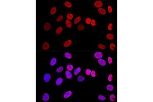 Immunofluorescence (IF) image for anti-Wilms Tumor 1 (WT1) (AA 1-302) antibody (ABIN7271369)