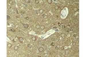 Immunohistochemistry of paraffin-embedded Rat hippocampal region tissue from a model with Alzheimer, using Phospho-Tau(S404) Polyclonal Antibody (tau Antikörper  (pSer404))