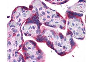 ATG5 antibody was used for immunohistochemistry at a concentration of 4-8 ug/ml. (ATG5 Antikörper)
