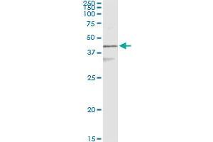 Immunoprecipitation (IP) image for anti-Keratin 17 (KRT17) (AA 1-432) antibody (ABIN561630)
