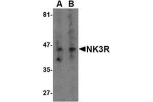 Image no. 1 for anti-Tachykinin Receptor 3 (TACR3) (Middle Region) antibody (ABIN318919) (TACR3 Antikörper  (Middle Region))